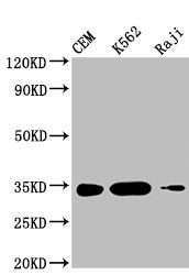 Western Blot Positive WB detected in: CEM whole cell lysate, K562 whole cell lysate, Raji whole cell lysate  All lanes: CTLA4 antibody at 1:1000 Secondary Goat polyclonal to mouse IgG at 1/50000 dilution Predicted band size: 25, 7, 9, 20 KDa Observed band size: 34 KDa Exposure time:5minMouse anti-Human CTLA4 Monoclonal antibody