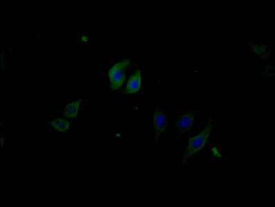 Immunofluorescence staining of Hela cells with Phospho-PERK(T981) Monoclonal Antibody at 1:100, counter-stained with DAPI. The cells were fixed in 4% formaldehyde and blocked in 10% normal Goat Serum. The cells were incubated with the antibody overnight at 4°C. Nuclear DNA was labeled in blue with DAPI. The secondary antibody was FITC-conjugated AffiniPure Goat Anti-Mouse IgG (H+L).Mouse anti-Human EIF2AK3 Monoclonal Antibody antibody