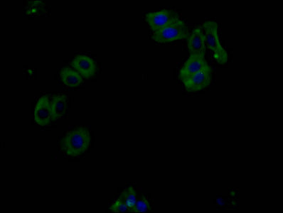 Immunofluorescence staining of U87 cells with Phospho-PERK(T981) Monoclonal Antibody at 1:100, counter-stained with DAPI. The cells were fixed in 4% formaldehyde and blocked in 10% normal Goat Serum. The cells were incubated with the antibody overnight at 4°C. Nuclear DNA was labeled in blue with DAPI. The secondary antibody was FITC-conjugated AffiniPure Goat Anti-Mouse IgG (H+L).Mouse anti-Human EIF2AK3 Monoclonal Antibody antibody
