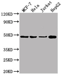 Western Blot  | Positive WB detected in: MCF-7 whole cell lysate, Hela whole cell lysate, Jurkat whole cell lysate, HepG2 whole cell lysate   | All lanes ENO1 antibody at 1:10000  | Secondary  | Goat polyclonal to mouse  IgG at 1/10000 dilution  | Predicted band size: 47 KDa  | Observed band size: 47 KDa  | Exposure time: 10sMouse anti-Human ENO1 Monoclonal antibody
