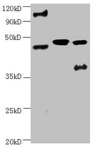 All lanes:Mouse anti-human ENO2 monoclonal antibody at 1μg/ml | Lane 1:Hela cell lysate | Lane 2:Recombinant Human Gamma-enolase(ENO2) at 10μg | Lane 3:U251 cell lysate | Secondary Goat polyclonal to Mouse IgG at 1/3000 dilution | Predicted band size : 43,48 kD | Observed band size: 48 kD | Additional bands at : 100kDa.mouse anti-Human ENO2 monoclonal antibody