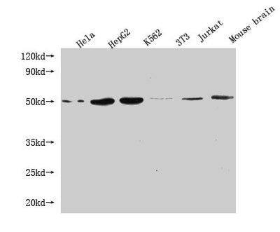 Western Blot Positive WB detected in: Hela whole cell lysate, HepG2 whole cell lysate, K562 whole cell lysate, 3T3 whole cell lysate, Jurkat whole cell lysate, Mouse brain tissue All lanes: FLOT1 antibody at 1:1000 Secondary Goat polyclonal to mouse IgG at 1/50000 dilution Predicted band size: 48, 43 kDa Observed band size: 48 KDa Exposure time：5minMouse anti-Human FLOT1 Monoclonal antibody
