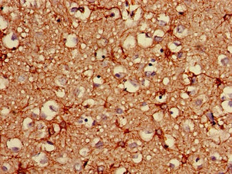 Immunohistochemistry of paraffin-embedded human brain tissue using GFAP Monoclonal Antibody at dilution of 1:100Mouse anti-Human GFAP Monoclonal Antibody