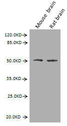Western BlotPositive WB detected in: Mouse brain tissue, Rat brain tissueAll lanes: GFAP antibody at 2.7µg/mlSecondaryGoat polyclonal to Mouse IgG at 1/10000 dilutionPredicted band size: 50, 51 kDaObserved band size: 50 kDaMouse anti-Human GFAP Monoclonal Antibody