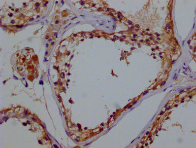 IHC image of GSTM3 Monoclonal Antibody diluted at 1:100 and staining in paraffin-embedded human testes tissue performed on a Leica BondTM system. After dewaxing and hydration, antigen retrieval was mediated by high pressure in a citrate buffer (pH 6.0). Section was blocked with 10% normal goat serum 30min at RT. Then primary antibody (1% BSA) was incubated at 4°C overnight. The primary is detected by a biotinylated secondary antibody and visualized using an HRP conjugated SP system.Mouse anti-Human GSTM3 Monoclonal Antibody antibody