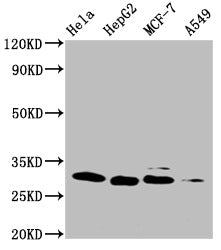 Western Blot Positive WB detected in: Hela whole cell lysate, HepG2 whole cell lysate, MCF-7 whole cell lysate, A549 whole cell lysate All lanes: GSTM3 antibody at 1:1000 Secondary Goat polyclonal to mouse IgG at 1/50000 dilution Predicted band size:  27 KDa Observed band size: 27 KDa Exposure time：10minMouse anti-Human GSTM3 Monoclonal Antibody antibody