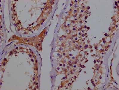 IHC image of GSTM3 Antibody diluted at 1:100 and staining in paraffin-embedded human testes tissue performed on a Leica BondTM system. After dewaxing and hydration, antigen retrieval was mediated by high pressure in a citrate buffer (pH 6.0). Section was blocked with 10% normal goat serum 30min at RT. Then primary antibody (1% BSA) was incubated at 4°C overnight. The primary is detected by a biotinylated secondary antibody and visualized using an HRP conjugated SP system.Mouse anti-Human GSTM3 Monoclonal Antibody antibody