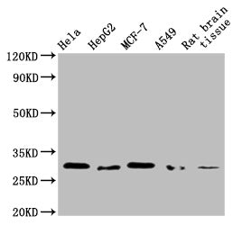 Western Blot Positive WB detected in: Hela whole cell lysate, HepG2 whole cell lysate, MCF-7 whole cell lysate, A549 whole cell lysate, Rat brain tissue All lanes: GSTM3 antibody at 1:1000 Secondary Goat polyclonal to mouse IgG at 1/50000 dilution Predicted band size: 27 KDa Observed band size: 27 KDa Exposure time：10minMouse anti-Human GSTM3 Monoclonal Antibody antibody