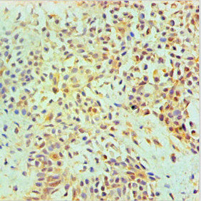 Immunohistochemical of paraffin-embedded Human Breast tissue using the antibody at dilution of 1:200.mouse anti-Human ANXA2 monoclonal antibody