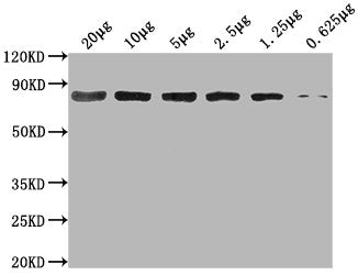 Western BlotPositive WB detected in: Hela whole cell lysate at 20μg, 10μg, 5μg, 2.5μg, 1.25μg, 0.625μgAll lanes: HSPA8 antibody at 1:2000SecondaryGoat polyclonal to mouse IgG at 1/50000 dilutionPredicted band size: 70~75 KDaObserved band size: 70~75 KDaExposure time: 10sMouse anti-Human HSPA8 Monoclonal antibody