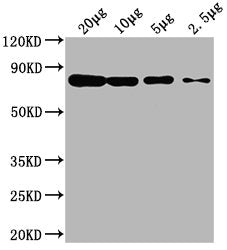 Western Blot  | Positive WB detected in: Hela whole cell lysate at 20μg, 10μg, 5μg, 2.5μg  | All lanes: HSPA8 antibody at 1:2000  | Secondary  | Goat polyclonal to mouse IgG at 1/50000 dilution  | Predicted band size: 70~75 KDa  | Observed band size: 70~75 KDa  | Exposure time: 5minMouse anti-Human HSPA8 Monoclonal antibody