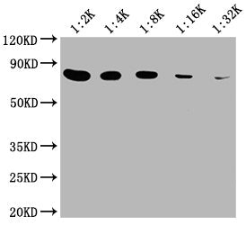 Western Blot  | Positive WB detected in: 20μg Hela whole cell lysate  | HSPA8 antibody at 1:2000, 1:4000, 1:8000, 1:16000, 1:32000  | Secondary  | Goat polyclonal to mouse IgG at 1/50000 dilution  | Predicted band size: 70~75 KDa  | Observed band size: 70~75 KDa  | Exposure time: 5minMouse anti-Human HSPA8 Monoclonal antibody