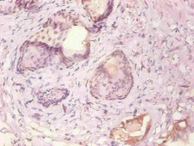 Immunohistochemical of paraffin-embedded human prostate tissue using KRT19 Monoclonal Antibody at dilution of 1:200