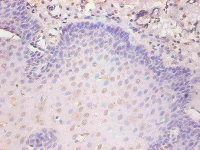 Immunohistochemical of paraffin-embedded human esophageal tissue using KRT19 Monoclonal Antibody at dilution of 1:200