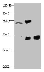 All lanes:Mouse anti-Human Cyfra21-1(KS19.1) monoclonal antibody at 4ug/ml  | Lane 1: MCF-7 cell lysate  | Lane2: MDA-MB-231 cell lysate  | Lane3: HepG2 cell lysate  | Secondary HRP labeled Goat polyclonal to Mouse IgG at 1/3000 dilution  | Predicted band size : 30 kDa  | Observed band size : 32 kDa  | Additional bands at: 50 kDa