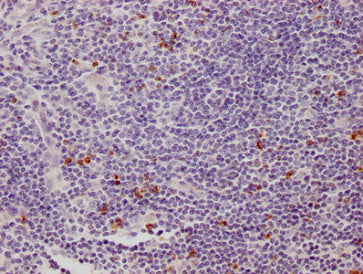IHC image of LAG3 Monoclonal Antibody diluted at 1:500 and staining in paraffin-embedded human appendix tissue performed on a Leica BondTM system. After dewaxing and hydration, antigen retrieval was mediated by high pressure in a citrate buffer (pH 6.0). Section was blocked with 10% normal goat serum 30min at 37°C Then primary antibody (1% BSA) was incubated at 4°C overnight. The primary is detected by a Goat anti-Mouse IgG labeled by HRP and visualized using 0.05% DAB.