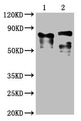 Western Blot Positive WB detected in: 1 lane: Recombinant proteins with LAG3; 2 lane: 293F whole cell lysate transfected with LAG3  All lanes: LAG3 antibody at 1:2000 Secondary Goat polyclonal to mouse IgG at 1/50000 dilution Predicted band size: 76, 88 KDa Observed band size: 76, 88 KDa Exposure time:5min
