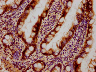 Immunohistochemical of paraffin-embedded human small intestinal tissue using LGALS3 Monoclonal Antibody at dilution of 1:100