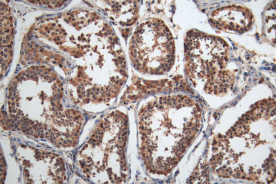 IHC image of the antibody diluted at 1:200 and staining in paraffin-embedded human testis tissue performed on a Leica BondTM system. After dewaxing and hydration, antigen retrieval was mediated by high pressure in a citrate buffer (pH 6.0). Section was blocked with 10% normal goat serum 30min at RT. Then primary antibody (1% BSA) was incubated at 4°C overnight. The primary is detected by a Goat anti-mouse polymer IgG labeled by HRP and visualized using 0.05% DAB.