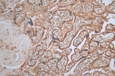 IHC image of MAGEA4 Monoclonal Antibody diluted at 1:200 and staining in paraffin-embedded human placenta tissue performed on a Leica BondTM system. After dewaxing and hydration, antigen retrieval was mediated by high pressure in a citrate buffer (pH 6.0). Section was blocked with 10% normal goat serum 30min at RT. Then primary antibody (1% BSA) was incubated at 4°C overnight. The primary is detected by a Goat anti-mouse polymer IgG labeled by HRP and visualized using 0.05% DAB.