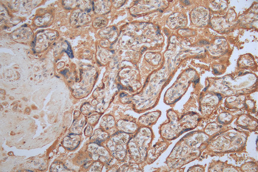 IHC image of MAGEA4 Monoclonal Antibody diluted at 1:200 and staining in paraffin-embedded human placenta tissue performed on a Leica BondTM system. After dewaxing and hydration, antigen retrieval was mediated by high pressure in a citrate buffer (pH 6.0). Section was blocked with 10% normal goat serum 30min at RT. Then primary antibody (1% BSA) was incubated at 4°C overnight. The primary is detected by a Goat anti-mouse polymer IgG labeled by HRP and visualized using 0.05% DAB.