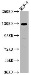 Western Blot  | Positive WB detected in: MCF-7 whole cell lysate  | All lanes: CD146 antibody at 1:1250  | Secondary  | Goat polyclonal to Mouse IgG at 1/50000 dilution  | Predicted band size: 72, 58 kDa  | Observed band size: 120 kDaMouse anti-Human CD146 Monoclonal Antibody