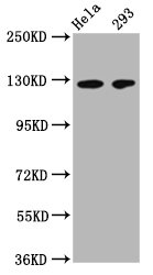 Western Blot  | Positive WB detected in: Hela whole cell lysate, 293 whole cell lysate  | All lanes: CD146 antibody at 1:500  | Secondary  | Goat polyclonal to Mouse IgG at 1/50000 dilution  | Predicted band size: 72, 58 kDa  | Observed band size: 120 kDaMouse anti-Human CD146 Monoclonal Antibody