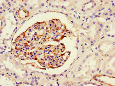 Immunohistochemistry of paraffin-embedded human kidney tissue using NES Monoclonal Antibody at dilution of 1:100Mouse anti-Human NES Monoclonal Antibody