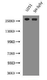 Western Blot  | Positive WB detected in: U251 whole cell lysate, SH-SY5Y whole cell lysate  | All lanes: NES antibody at 3µg/ml  | Secondary  | Goat polyclonal to Mouse IgG at 1/10000 dilution  | Predicted band size: 178 kDa  | Observed band size: 260 kDaMouse anti-Human NES Monoclonal Antibody