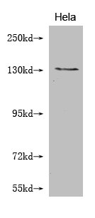 Western Blot Positive WB detected in: Hela whole cell lysate  All lanes: NOS2 antibody at 1:2000 Secondary Goat polyclonal to mouse IgG at 1/50000 dilution Predicted band size: 131, 127 kDa Observed band size: 131 KDa Exposure time：5minMouse anti-Human NOS2 Monoclonal antibody
