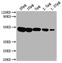 Western Blot  | Positive WB detected in: Hela whole cell lysate at 20μg, 10μg, 5μg, 2.5μg, 1.25μg   | All lanes: PD-L2 antibody at 1:2000  | Secondary  | Goat polyclonal to mouse IgG at 1/50000 dilution  | Predicted band size: 31,21 KDa  | Observed band size: 45-50 KDa  | Exposure time:5minMouse anti-Human PD-L2 Monoclonal Antibody antibody