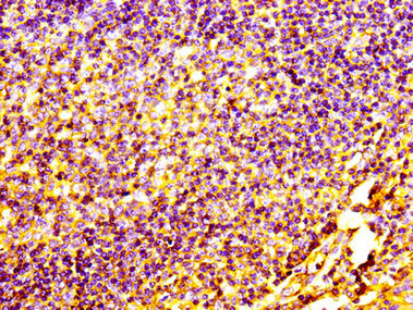IHC image of CD31 Monoclonal Antibody diluted at 1:100 and staining in paraffin-embedded human tonsil tissue performed on a Leica BondTM system. After dewaxing and hydration, antigen retrieval was mediated by high pressure in a citrate buffer (pH 6.0). Section was blocked with 10% normal goat serum 30min at RT. Then primary antibody (1% BSA) was incubated at 4°C overnight. The primary is detected by a biotinylated secondary antibody and visualized using an HRP conjugated SP system.Mouse anti-Human CD31 Monoclonal Antibody