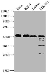 Western Blot  | Positive WB detected in:  Hela whole cell lysate, MCF-7 whole cell lysate, Jurkat whole cell lysate, NIH/3T3 whole cell lysate  | All lanes: PKM antibody at 1:4000  | Secondary  | Goat polyclonal to Mouse IgG at 1/10000 dilution  | Predicted band size: 58 kDa  | Observed band size: 58 KDa  | Exposure time: 1minMouse anti-Human PKM Monoclonal antibody