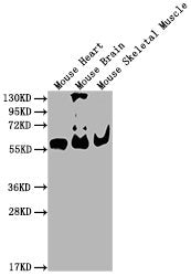 Western Blot  | Positive WB detected in:  Mouse Heart tissue, Mouse Brain tissue, Mouse Skeletal Muscle tissue  | All lanes: PKM antibody at 1:4000  | Secondary  | Goat polyclonal to Mouse IgG at 1/10000 dilution  | Predicted band size: 58 kDa  | Observed band size: 58 KDaMouse anti-Human PKM Monoclonal antibody