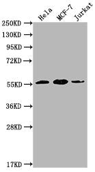Western Blot  | Positive WB detected in:  Hela whole cell lysate, MCF-7 whole cell lysate, Jurkat whole cell lysate  | All lanes: PKM antibody at 1:5000  | Secondary  | Goat polyclonal to Mouse IgG at 1/10000 dilution  | Predicted band size: 58 kDa  | Observed band size: 58 KDa  | Exposure time: 1minMouse anti-Human PKM Monoclonal antibody