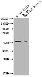 Western Blot  | Positive WB detected in:  Mouse Brain tissue, Mouse Skeldtal Muscle tissue  | All lanes: PKM antibody at 1:1000  | Secondary  | Goat polyclonal to Mouse IgG at 1/10000 dilution  | Predicted band size: 58 kDa  | Observed band size: 58 KDa  | Exposure time: 5minMouse anti-Human PKM Monoclonal antibody