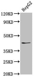 Western Blot  | Positive WB detected in: HepG2 whole cell lysate  | All lanes: OCT4 antibody at 1:500  | Secondary  | Goat polyclonal to Mouse IgG at 1/10000 dilution  | Predicted band size: 39, 31 kDa  | Observed band size: 45 kDaMouse anti-Human OCT4 Monoclonal Antibody