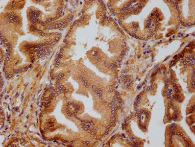 IHC image of PRDX3 Monoclonal Antibody diluted at 1:50 and staining in paraffin-embedded human prostate tissue performed on a Leica BondTM system. After dewaxing and hydration, antigen retrieval was mediated by high pressure in a citrate buffer (pH 6.0). Section was blocked with 10% normal goat serum 30min at RT. Then primary antibody (1% BSA) was incubated at 4°C overnight. The primary is detected by a biotinylated secondary antibody and visualized using an HRP conjugated SP system.Mouse anti-Human PRDX3 Monoclonal antibody