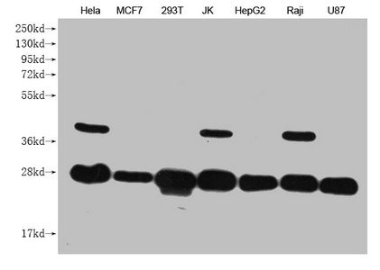 Western Blot Positive WB detected in: Hela whole cell lysate, MCF7 whole cell lysate, 293T whole cell lysate, JK whole cell lysate, HepG2 whole cell lysate, Raji whole cell lysate, U87 whole cell lysate  All lanes: PRDX3 antibody at 1:1000 Secondary Goat polyclonal to mouse IgG at 1/50000 dilution Predicted band size: 28 kDa Observed band size: 28 KDa Exposure time：5minMouse anti-Human PRDX3 Monoclonal antibody