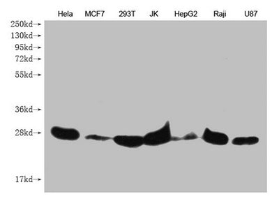 Western Blot Positive WB detected in: Hela whole cell lysate, MCF7 whole cell lysate, 293T whole cell lysate, JK whole cell lysate, HepG2 whole cell lysate, Raji whole cell lysate, U87 whole cell lysate  All lanes: PRDX3 antibody at 1:1000 Secondary Goat polyclonal to mouse IgG at 1/50000 dilution Predicted band size: 28 kDa Observed band size: 28 KDa Exposure time：5minMouse anti-Human PRDX3 Monoclonal antibody
