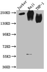Western Blot  | Positive WB detected in: Jurkat whole cell lysate, Raji whole cell lysate, THP-1 whole cell lysate  | All lanes CD45 antibody at 1:2000  | Secondary  | Goat polyclonal to mouse IgG at 1/50000 dilution  | Predicted band size: 148, 132, 143, 141, 139, 136 KDa  | Observed band size: 180-250 KDa  | Exposure time:15minMouse anti-Human CD45 Monoclonal Antibody