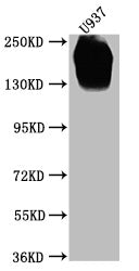 Western Blot  | Positive WB detected in: U937 whole cell lysate  | All lanes CD45 antibody at 1:2000  | Secondary  | Goat polyclonal to mouse IgG at 1/50000 dilution  | Predicted band size: 148, 132, 143, 141, 139, 136 KDa  | Observed band size: 180-250 KDa  | Exposure time:5minMouse anti-Human CD45 Monoclonal Antibody