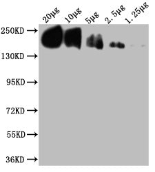 Western Blot  | Positive WB detected in: THP-1whole cell lysate at 20μg, 10μg, 5μg, 2.5μg, 1.25μg All lanes: CD45 antibody at 1:2000  | Secondary  | Goat polyclonal to mouse IgG at 1/50000 dilution  | Predicted band size: 148, 132, 143, 141, 139, 136 KDa  | Observed band size: 180-250 KDa  | Exposure time:15minMouse anti-Human CD45 Monoclonal Antibody