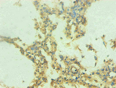 Immunohistochemical of paraffin-embedded human lung tissue using the antibody at dilution of 1:200mouse anti-Human S100A9 monoclonal antibody