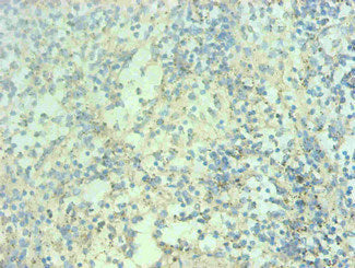 Immunohistochemical of paraffin-embedded human spleen tissue using S100A9 Monoclonal Antibody at dilution of 1:200mouse anti-Human S100A9 monoclonal antibody