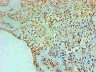 Immunohistochemical of paraffin-embedded Human Breast tissue using TGM2 Monoclonal Antibody at dilution of 1:200.mouse anti-Human TGM2 monoclonal antibody