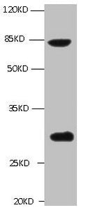 All lanes: Mouse anti-TGM2 Monoclonal antibody at 1μg/ml | Lane 1 : A549 whole cell lysate | Secondary Goat polyclonal to Mouse IgG at 1/5000 dilution | Predicted band size :77kd | Observed band size :77,62,39KD | Additional bands at :30kdmouse anti-Human TGM2 monoclonal antibody