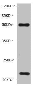 All lanes:Mouse anti-Human Timp1 monoclonal antibody at 1μg/ml  | Lane 1: HepG-2 cell lysate  | Predicted band size : 23 kDa  | Observed band size : 23 kDa  | Additional bands at:50KDmouse anti-Human TIMP1 Monoclonal Antibody