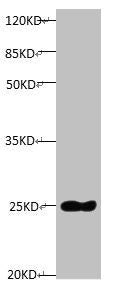 All lanes: Mouse anti-Human Timp1 monoclonal antibody at 1μg/ml  | Lane 1: TIMP1 transfected pichia Yeast cell lysate  | Predicted band size : 23 kDa  | Observed band size:23 kDamouse anti-Human TIMP1 Monoclonal Antibody