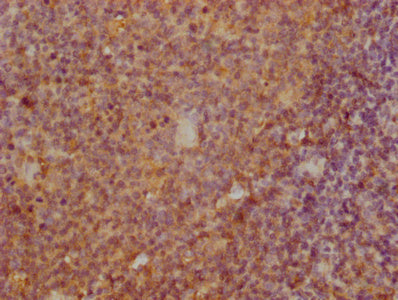 IHC image of TNFRSF17 Monoclonal Antibody diluted at 1:100 and staining in paraffin-embedded human tonsil tissue performed on a Leica BondTM system. After dewaxing and hydration, antigen retrieval was mediated by high pressure in a citrate buffer (pH 6.0). Section was blocked with 10% normal goat serum 30min at 37°C Then primary antibody (1% BSA) was incubated at 4°C overnight. The primary is detected by a Goat anti-Mouse IgG labeled by HRP and visualized using 0.05% DAB.Mouse anti-Human TNFRSF17 Monoclonal antibody